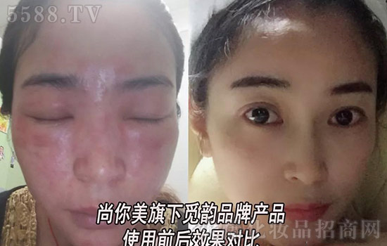 加入尚你美 加入尚你美