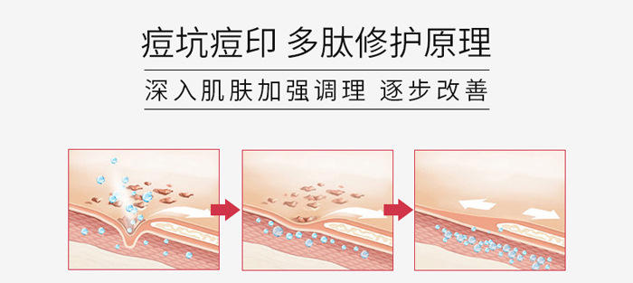 暨美科颜多肽祛痘冻干粉套盒