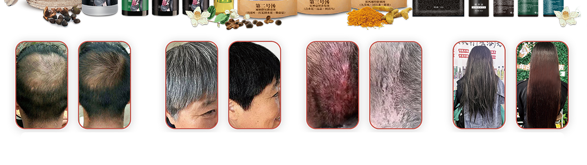 ͷƼ
